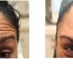 before and after