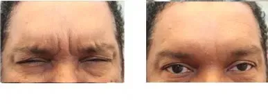 before and after