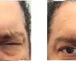 before and after
