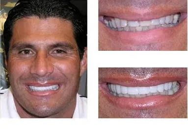 Man smiling