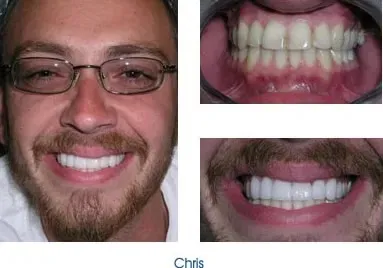 Man showing his teeth
