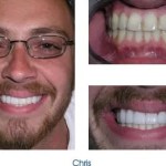 Man showing his teeth
