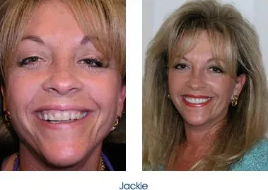 Woman showing her teeth