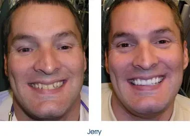 Before and after teeth repair