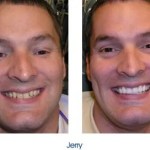 Before and after teeth repair
