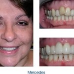 Before and after teeth repair