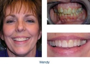 Before and after teeth repair